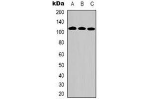 Western blot analysis of DPD expression in Hela (A), HepG2 (B), Jurkat (C) whole cell lysates. (DPYD anticorps)