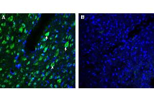 Expression of AXL in rat parietal cortex.