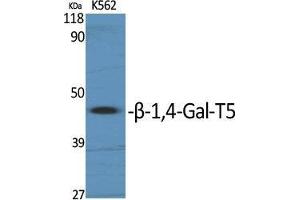 Western Blot (WB) analysis of specific cells using beta-1,4-Gal-T5 Polyclonal Antibody.