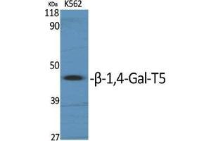 Western Blot (WB) analysis of specific cells using beta-1,4-Gal-T5 Polyclonal Antibody. (B4GALT5 anticorps  (C-Term))