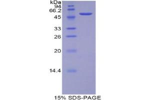 SDS-PAGE analysis of Rat TFAM Protein. (TFAM Protéine)