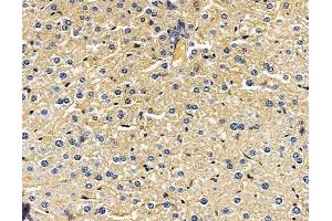 ABIN7095962 and ABIN7100024 at 1/100 staining mouse liver tissue by IHC-P.