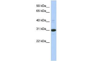 WB Suggested Anti-IMPA1 Antibody Titration: 0. (IMPA1 anticorps  (Middle Region))