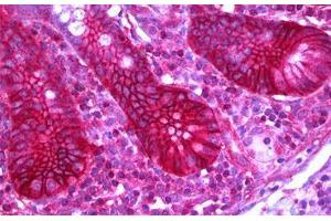 Anti-SLC12A2 / NKCC1 antibody IHC staining of human small intestine.