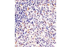 (ABIN6243124 and ABIN6578087) staining DPYSL5 in human tonsil sections by Immunohistochemistry (IHC-P - paraformaldehyde-fixed, paraffin-embedded sections). (DPYSL5 anticorps  (C-Term))