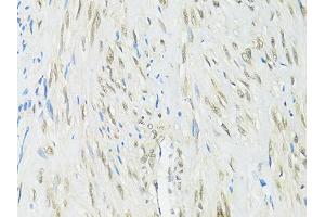 Immunohistochemistry of paraffin-embedded human uterus using RBFOX3 antibody (ABIN1874561) at dilution of 1:100 (40x lens). (NeuN anticorps)
