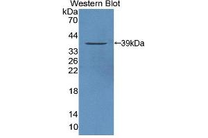 Figure. (PTPN9 anticorps  (AA 289-593))