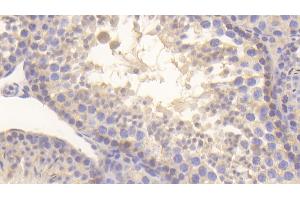 Detection of MIF in Mouse Testis Tissue using Polyclonal Antibody to Macrophage Migration Inhibitory Factor (MIF)