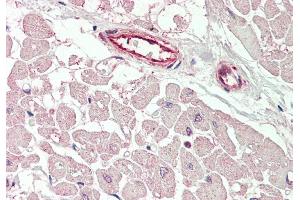 Rabbit Anti-KCNIP2 antibody  Formalin Fixed Paraffin Embedded Tissue: Human Heart Primary antibody Concentration: 1:100 Secondary Antibody: Donkey anti-Rabbit-Cy3 Secondary Antibody Concentration: 1:200 Magnification: 20x Exposure Time: 0. (KCNIP2 anticorps  (N-Term))