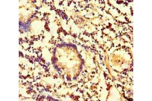 Immunohistochemistry of paraffin-embedded human appendix tissue using ABIN7146751 at dilution of 1:100 (CES3 anticorps  (AA 65-233))