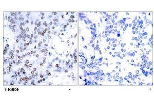Image no. 1 for anti-Jun B Proto-Oncogene (JUNB) (AA 77-81) antibody (ABIN197138) (JunB anticorps  (AA 77-81))