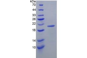 SDS-PAGE analysis of Mouse Interleukin 17C Protein. (IL17C Protéine)