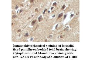 Image no. 1 for anti-Udp-N-Acetyl-alpha-D-Galactosamine:polypeptide N-Acetylgalactosaminyltransferase 9 (GalNAc-T9) (GALNT9) antibody (ABIN791210)