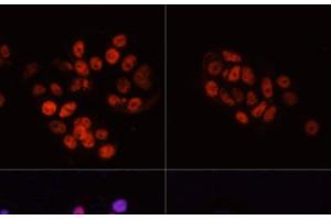 Immunofluorescence analysis of MCF7 cells using Phospho-POLR2A(S5) Polyclonal Antibody at dilution of 1:100. (POLR2A/RPB1 anticorps  (pSer5))