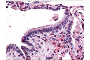 Human Lung, Respiratory Epithelium: Formalin-Fixed, Paraffin-Embedded (FFPE)