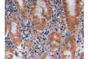 Detection of MGMT in Human Stomach Tissue using Polyclonal Antibody to O-6-Methylguanine DNA Methyltransferase (MGMT)