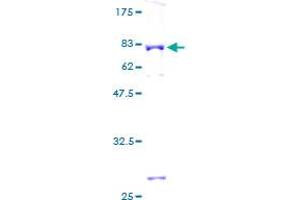 Image no. 1 for Aminoacylase 1 (ACY1) (AA 1-408) protein (GST tag) (ABIN1305823)