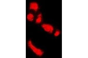 Immunofluorescent analysis of PADI4 staining in U2OS cells.
