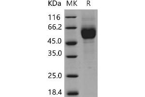Western Blotting (WB) image for Interleukin 1 Receptor, Type I (IL1R1) (Active) protein (His tag) (ABIN7320139) (IL1R1 Protein (His tag))