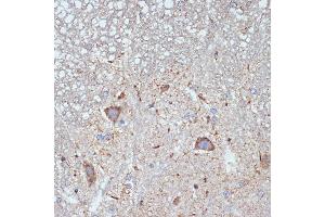 Immunohistochemistry of paraffin-embedded mouse spinal cord using CBR1 Rabbit mAb (ABIN7266076) at dilution of 1:100 (40x lens). (CBR1 anticorps)