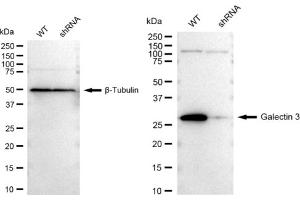 Western blotting analysis using Galectin 3 antibody (ABIN7798687). (Recombinant Galectin 3 anticorps)