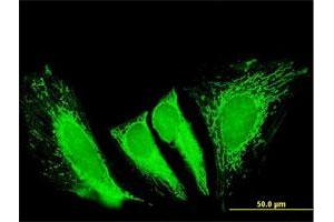 Immunofluorescence of purified MaxPab antibody to RTKN2 on HeLa cell.