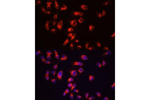 Immunofluorescence analysis of  cells using Tau antibody (ABIN3021441, ABIN3021442, ABIN3021443 and ABIN6215045) at dilution of 1:100 (40x lens).