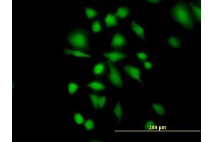 Immunofluorescence of purified MaxPab antibody to ETHE1 on HeLa cell. (ETHE1 anticorps  (AA 1-254))