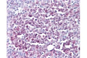 Anti-MCM5 antibody IHC of human tonsil.