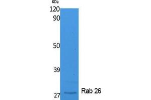Western Blotting (WB) image for anti-RAB26, Member RAS Oncogene Family (RAB26) (C-Term) antibody (ABIN3178106) (RAB26 anticorps  (C-Term))