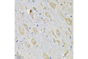 Immunohistochemistry of paraffin-embedded mouse brain using TXNDC5 Antibody.