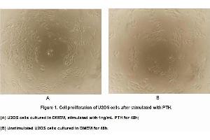 Image no. 2 for Parathyroid Hormone (PTH) (AA 32-115) (Active) protein (MBP tag,His tag) (ABIN6239833)