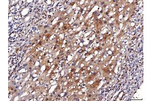 IHC analysis of ENO1 using anti-ENO1 antibody (ABIN7601902). (ENO1 anticorps  (AA 50-250))