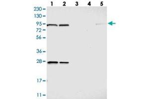 Western blot analysis of Lane 1: RT-4, Lane 2: U-251 MG, Lane 3: Human Plasma, Lane 4: Liver, Lane 5: Tonsil with GCS1 polyclonal antibody . (GCS1 anticorps)