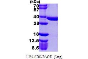 SDS-PAGE (SDS) image for Phosphopantothenoylcysteine Synthetase (PPCS) (AA 1-331) protein (His tag) (ABIN667454)