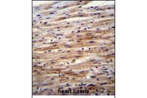 SFRP2 Antibody (C-term) (ABIN6243546 and ABIN6577328) immunohistochemistry analysis in formalin fixed and paraffin embedded human heart tissue followed by peroxidase conjugation of the secondary antibody and DAB staining. (SFRP2 anticorps  (C-Term))