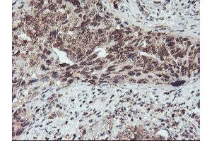 Image no. 9 for anti-Fragile X Mental Retardation 1 (FMR1) (AA 26-279) antibody (ABIN1491292)