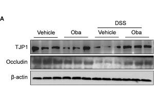 Obacunone inhibited the DSS-induced loss of TJP1 and occludin protein expression. (Occludin anticorps  (AA 263-522))