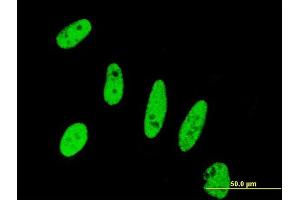 Immunofluorescence of monoclonal antibody to BIRC5 on HeLa cell.