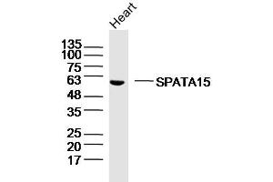 Mouse heart lysates probed with SPATA15/SPATC1 Polyclonal Antibody, Unconjugated  at 1:300 dilution and 4˚C overnight incubation. (SPATC1 anticorps  (AA 1-100))