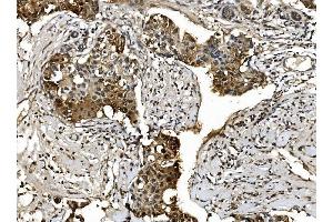 IHC analysis of Proteasome 20S Beta 7/PSMB7 using anti-Proteasome 20S Beta 7/PSMB7 antibody (ABIN7600256).