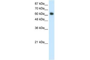 WB Suggested Anti-FOXG1B Antibody Titration:  1. (FOXG1 anticorps  (C-Term))