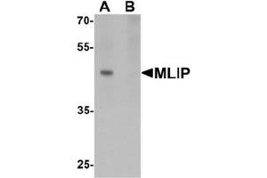 Western blot analysis of MLIP in 293 cell lysate with MLIP antibody at 1 ug/mL in (A) the absence and (B) the presence of blocking peptide. (MLIP anticorps  (C-Term))