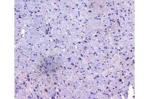 IHC analysis of PCDH15 using anti-PCDH15 antibody (ABIN6719362). (PCDH15 anticorps)