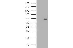 Image no. 1 for anti-Vimentin (VIM) (AA 210-466) antibody (ABIN1491207) (Vimentin anticorps  (AA 210-466))