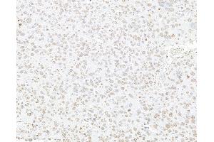Immunohistochemistry (IHC) image for anti-Histone H3 (H3) (C-Term) antibody (ABIN7455227)