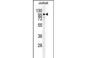 ZN Antibody (N-term) (ABIN655428 and ABIN2844965) western blot analysis in Jurkat cell line lysates (35 μg/lane). (ZNF841 anticorps  (N-Term))