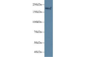 Detection of MYH1 in Mouse Serum using Polyclonal Antibody to Myosin Heavy Chain 1 (MYH1)