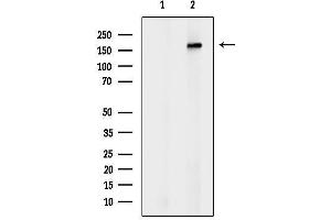 Western blot analysis of lysates from Rat lung, using ABC Antibody.