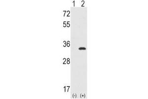 Western blot analysis of CDC2 antibody and 293 cell lysate either nontransfected (Lane 1) or transiently transfected with the CDC2 gene (2). (CDK1 anticorps  (AA 1-29))